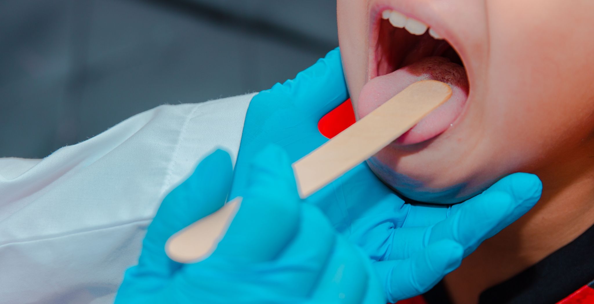 Posterior tongue tie symptoms, Tongue tie in infants, Diagnosing posterior tongue tie, Effects of tongue tie on speech, Posterior tongue restriction, Tongue tie breastfeeding issues, Posterior ankyloglossia